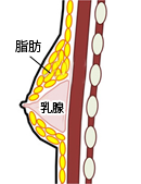 真性女性化乳房